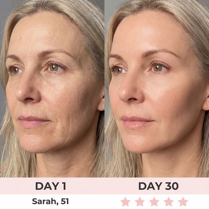 Zenoria® 7-in-1 EMS + Red Light Therapy To Lift & Sculpt Your Face