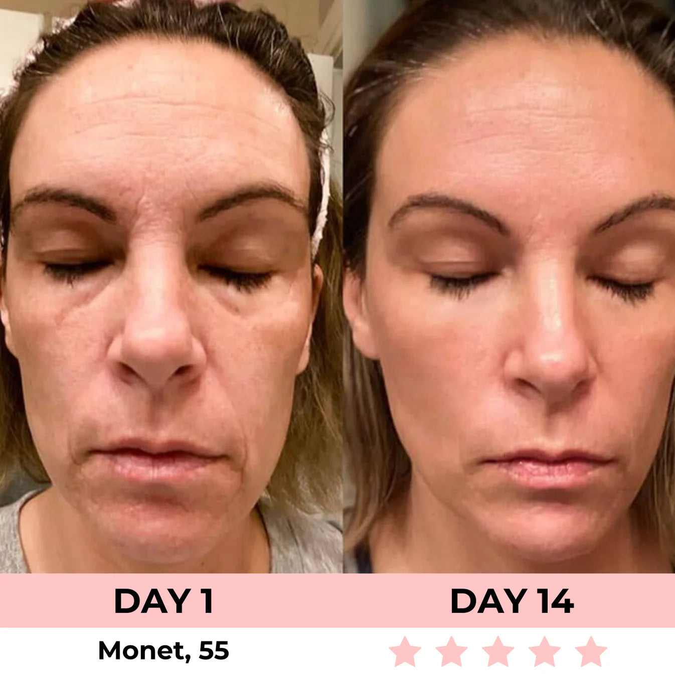 Zenoria® 7-in-1 EMS + Red Light Therapy To Lift & Sculpt Your Face
