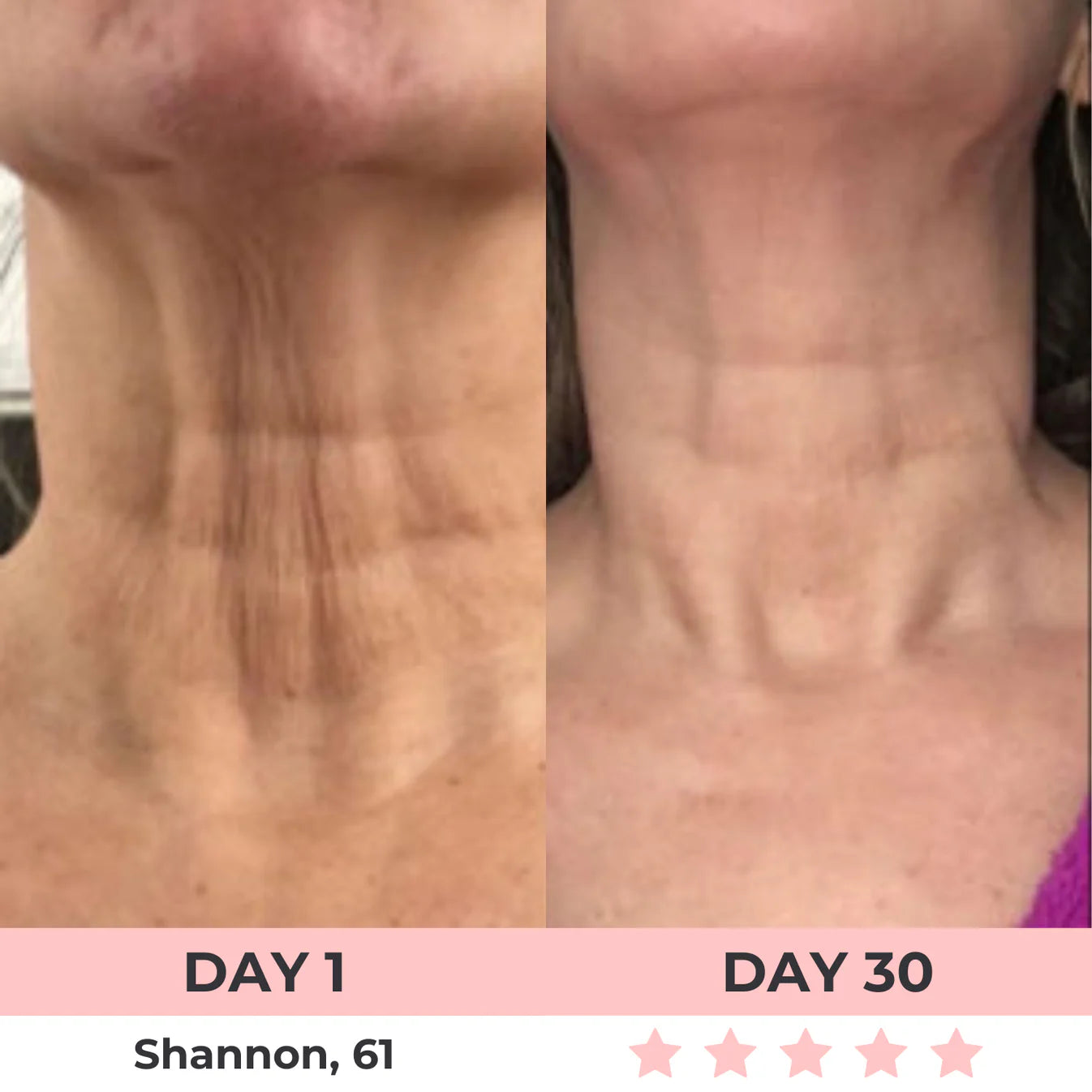 Zenoria® 7-in-1 EMS + Red Light Therapy To Lift & Sculpt Your Face