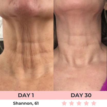 Zenoria® 7-in-1 EMS + Red Light Therapy To Lift & Sculpt Your Face
