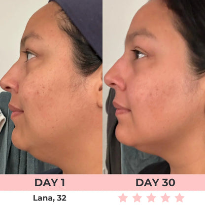 Zenoria® 7-in-1 EMS + Red Light Therapy To Lift & Sculpt Your Face