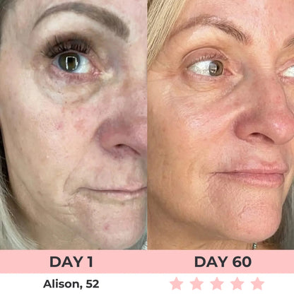 Zenoria® 7-in-1 EMS + Red Light Therapy To Lift & Sculpt Your Face